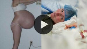 Pregnant Mom Thinks Shes Having Twins Until Doctors Discover Danger